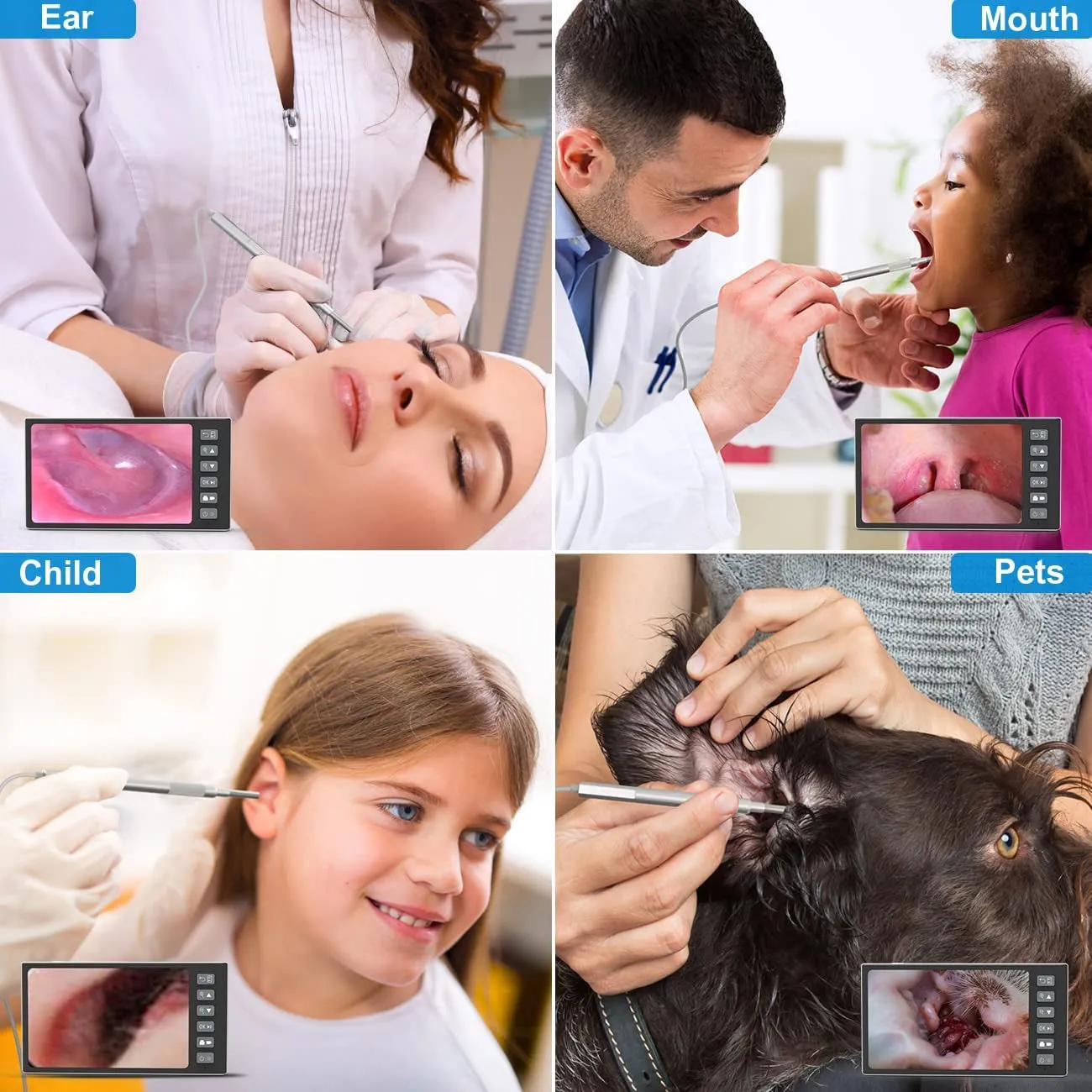 Digital Otoscope with 7 Inch IPS Screen,  Ear Wax Removal Tool Camera, 3.9Mm HD Ear Scope Otoscope with Light, Ear Camera and Wax Remover, Supports Photo Snap and Video Recording, 32GB Card